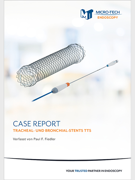 Case Report Tracheal und Bronchial Stents TTS