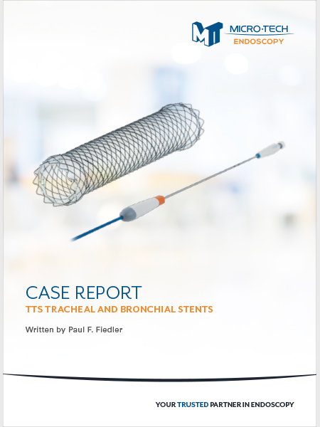TTS Bronchial Stent Digital Case Report